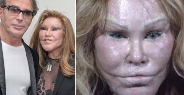 Jocelyn Wildenstein - worst plastic surgeries of popular celebrities